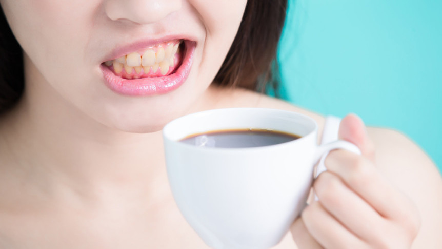 Thumbnail of [Teeth Whitening] Yellow Teeth: Surface Stains or Internal Discoloration? 3 Treatments + Care Tips