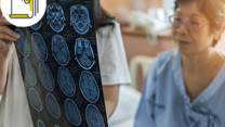 Thumbnail of Dual Tracer PET Scan for Alzheimer's Disease