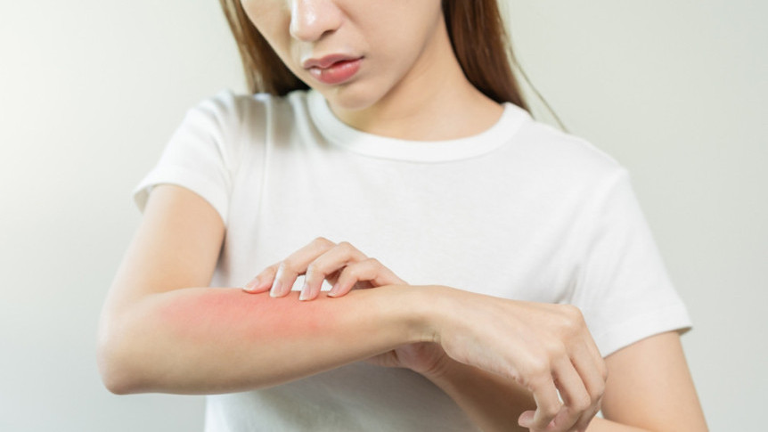 Thumbnail of 4 Tips of Combating Eczema and Dust Mite Allergy