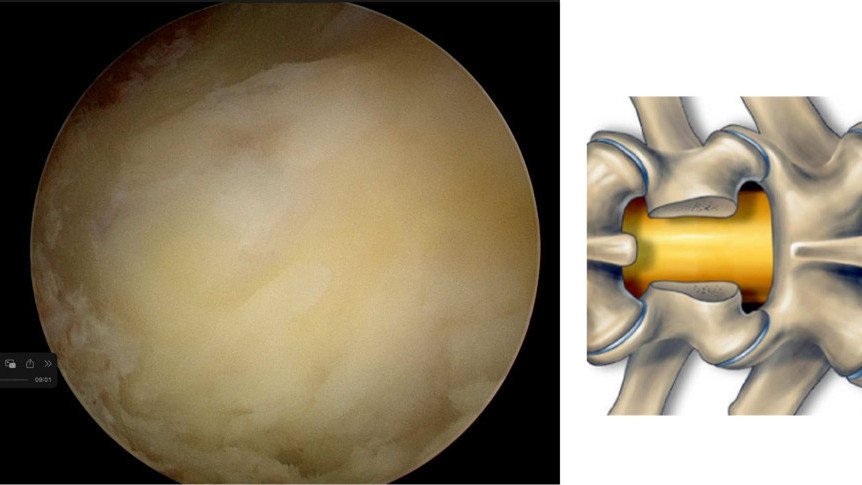 Thumbnail of Treatment of Sciatica