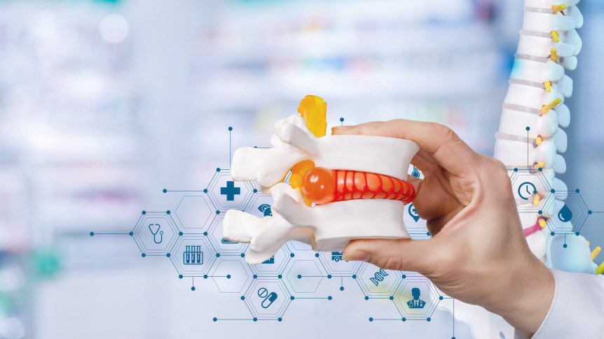 Thumbnail of Lifestyle and Spinal Health