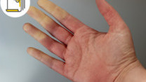 Thumbnail of Rheumatism is Incurable? Understanding its Causes and Symptoms and Seek Medical Advices Whenever Deemed Necessary