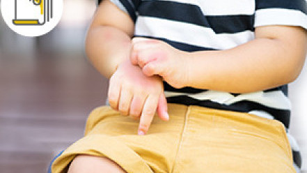 Thumbnail of Children's Allergies - Eight Types of Highly Allergic Food Early Adoption of Diversified Diet Can Help Reduce Food Allergy