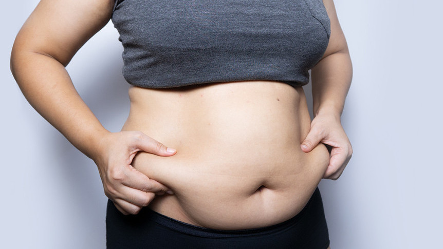 Thumbnail of What is Obesity?