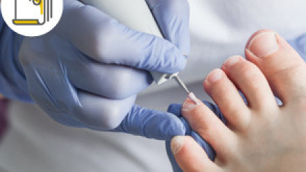 Thumbnail of Ingrown Toenail Caused Skin Damage and Pus  Mishandling of Toenail Cutting and Putting on Wrong Shoes are the Culprits?