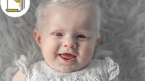 Thumbnail of Know More About Albinism