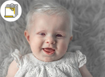 Thumbnail of Know More About Albinism