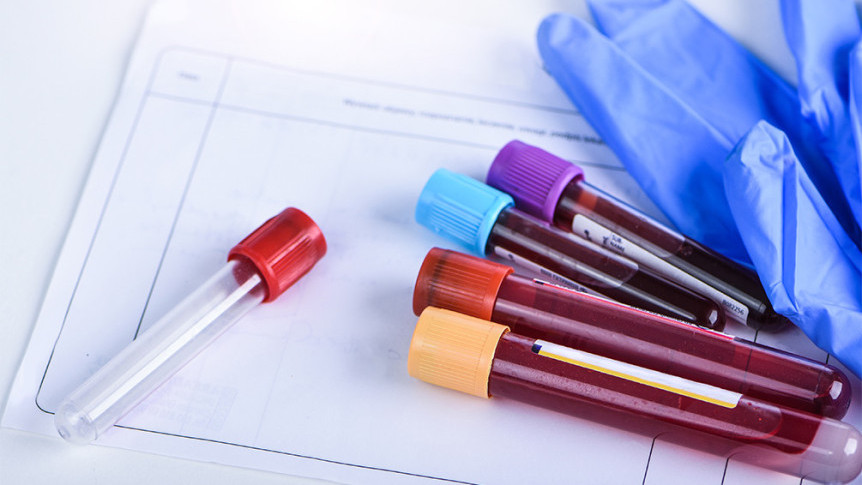 Thumbnail of A Look into Health Assessments (Part 1) - Routine Blood Examination
