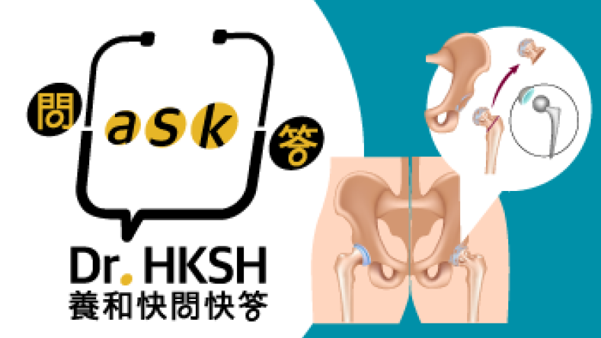 Thumbnail of “Ask Dr. HKSH” - Hip Replacement Surgery