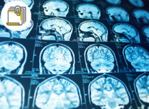 Thumbnail of Personalised Treatment - The Evolution of Diagnostic And Interventional Radiology
