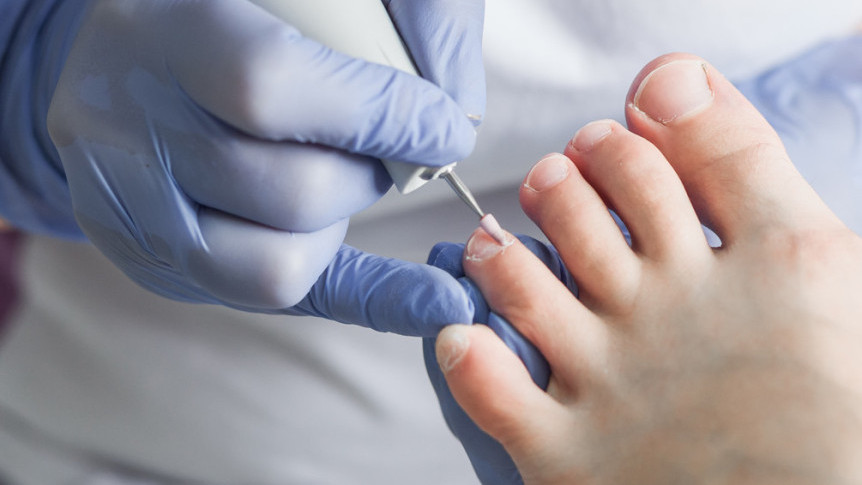 Thumbnail of Beware of Common Foot Issues