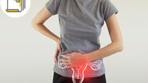 Thumbnail of Treatment of Prolapse of Uterus