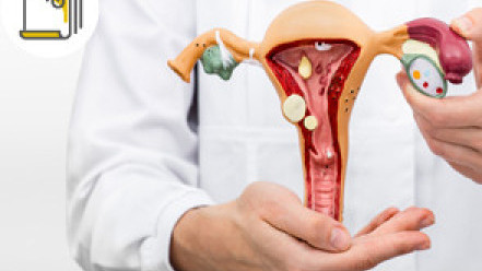 Thumbnail of Treatment of Uterine Fibroids