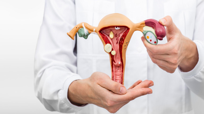 Thumbnail of Treatment of Uterine Fibroids