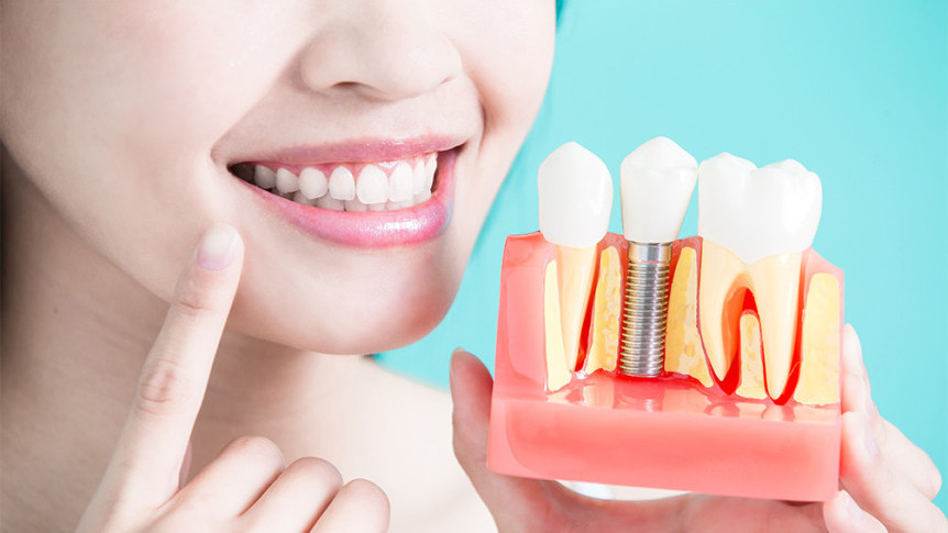 Thumbnail of The Difference Between Permanent and Removable Dentures