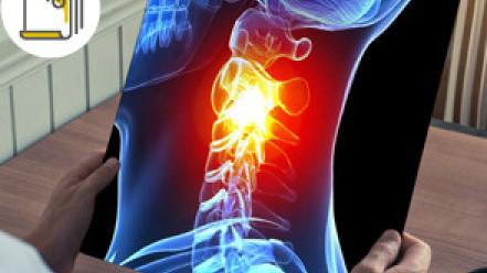 Thumbnail of Effects of Poor Posture on Cervical Spine Injuries