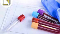 Thumbnail of Introduction to Haemophilia: Symptoms, Diagnosis and Treatment