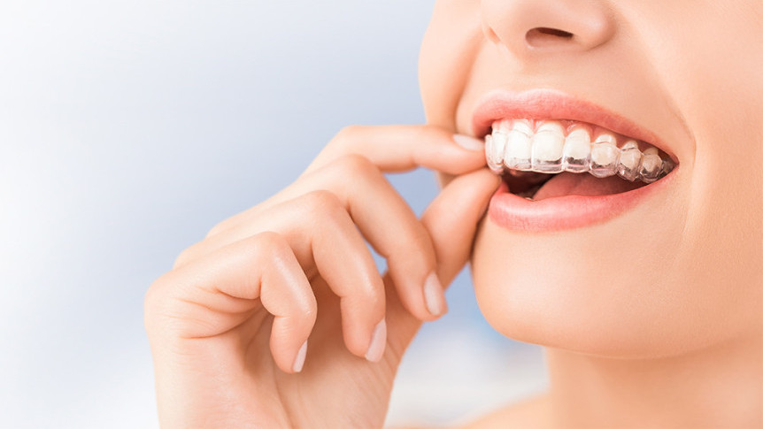 Thumbnail of Teeth Whitening and Aesthetic Dentistry