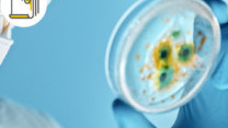 Thumbnail of Candida Auris