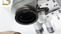 Thumbnail of Causes of Early Cataracts