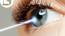 Thumbnail of Latest Advances in Surgeries for Vision Correction