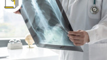 Thumbnail of Mesothelioma