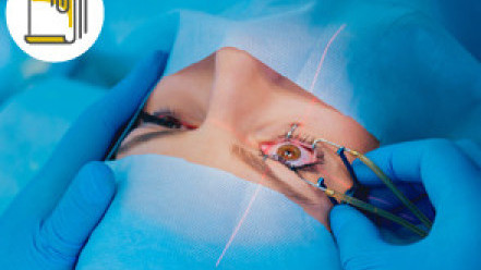 Thumbnail of Cataract Surgery and Lens Options