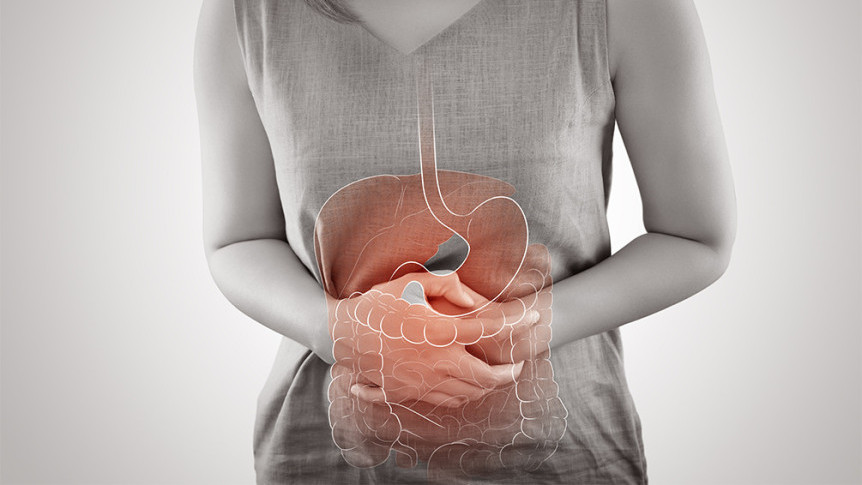 Thumbnail of Treatment of Irritable Bowel Syndrome (IBS)