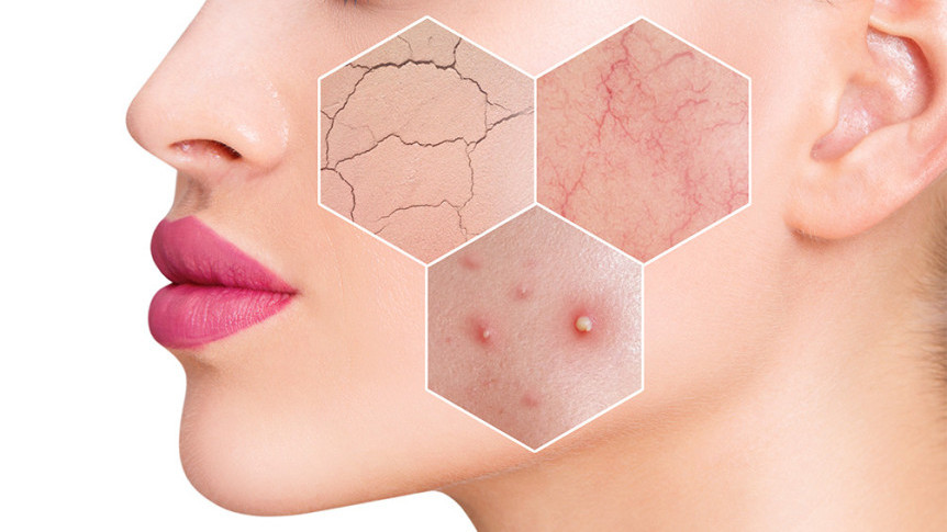 Thumbnail of Women Skincare Tips