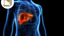 Thumbnail of Treatment of Different Stages of Liver Cancer