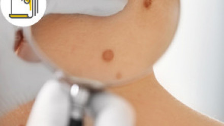Thumbnail of Teenage Acne
