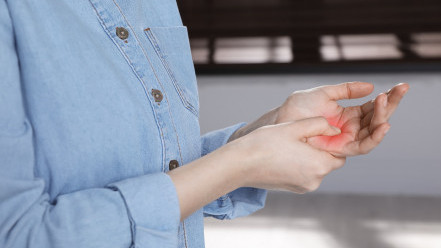 Thumbnail of Is a Trigger Finger Possibly a "Rheumatic" Condition?