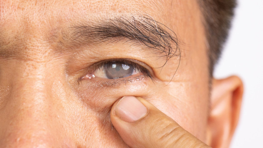 Cataract Surgery: Personalised Lens Replacement for Treatment and Vision Correction