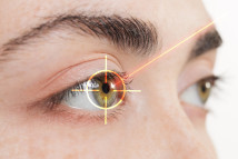 Thumbnail of 'Wavelight Plus' Laser Eye Surgery: Full-Eye Scans and Personalised 3D Eye Mapping for Precision Vision Correction