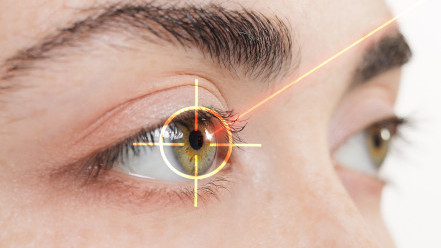 Thumbnail of 'Wavelight Plus' Laser Eye Surgery: Full-Eye Scans and Personalised 3D Eye Mapping for Precision Vision Correction
