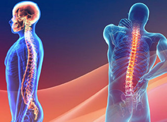 Thumbnail of HKSH Releases Survey Results on Spinal Health in Hong Kong Nearly 90% of Respondents Report Spinal Problems Impacting Daily Life