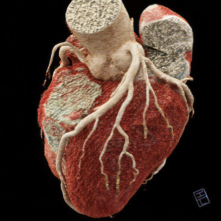 Thumbnail of Who Needs a CT Scan?