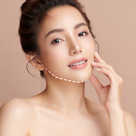 Thumbnail of Jaw Reduction Surgery