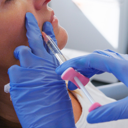 Thumbnail of Botulinum A Toxin Injection