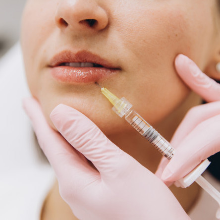 Thumbnail of Hyaluronic Acid Injection