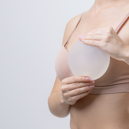 Thumbnail of Breast Reconstruction with Implant