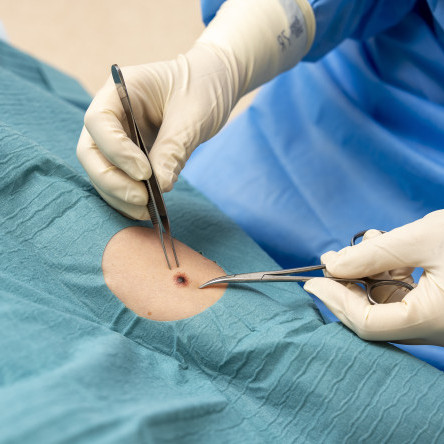 Thumbnail of Treatment