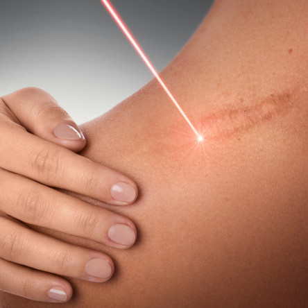 Thumbnail of Treatment