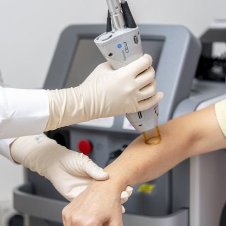 Thumbnail of Hair Removal
