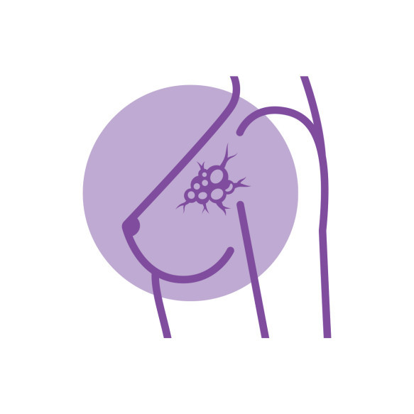 Breast