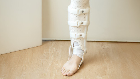 Thumbnail of Neurological Orthotic Management