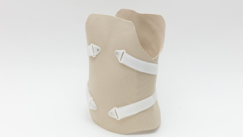 Thumbnail of Upper Limb Prosthesis