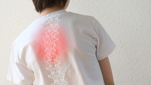 Thumbnail of Scoliosis Spinal Brace Service 