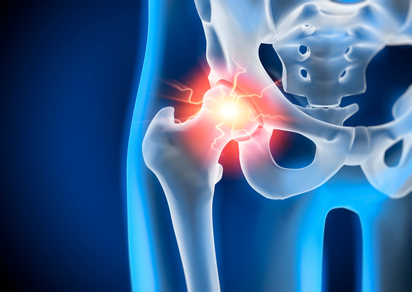 Hip Fracture Programme