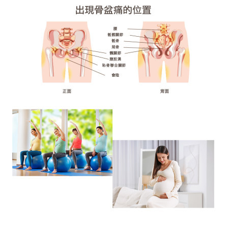 縮圖 - 骨盆痛